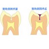 陽泉銷量好的基礎(chǔ)牙科中心【薦】，微創(chuàng)拔牙